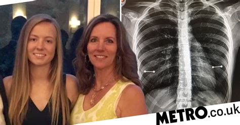 Mum Finds Out Daughter Has Nipple Piercings After X Ray Metro News