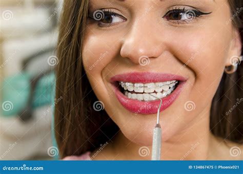Dental Brace Teen Girl Smiling Looking On A Camera Royalty Free Stock