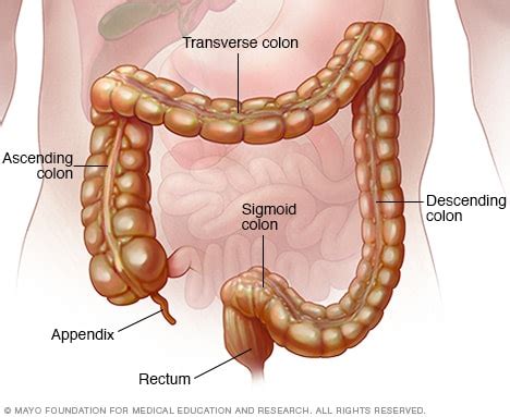 microscopic colitis symptoms   mayo clinic