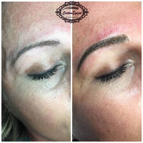 microblading and microshading alite laser hair removal