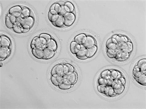 understanding ivf embryo grading systems arc fertility