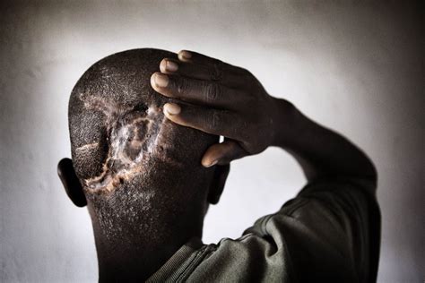 images lra victims in drc pulitzer center