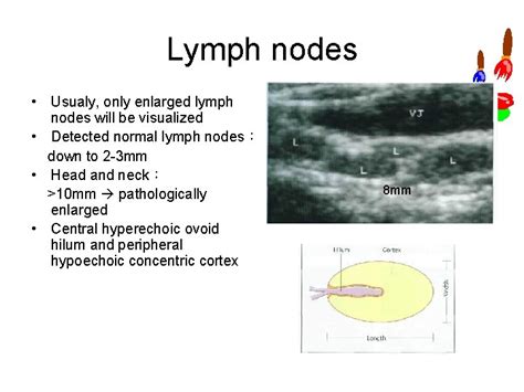 Lymph Nodes Differential Diagnosis In Ultrasound Imaging P My Xxx Hot