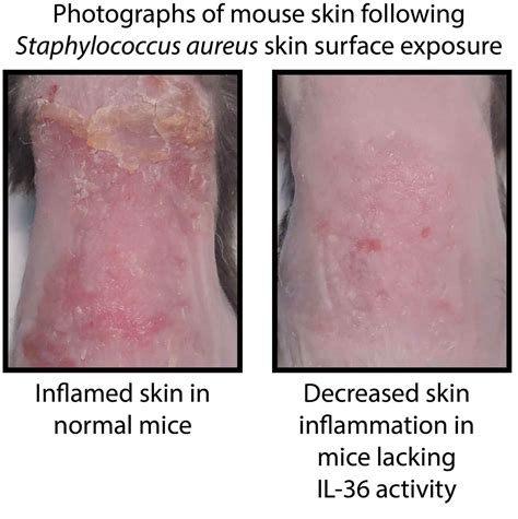 skin  inflamed