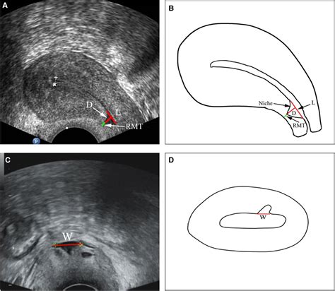 Frontiers Comparative Effectiveness Of Transvaginal Repair Vs