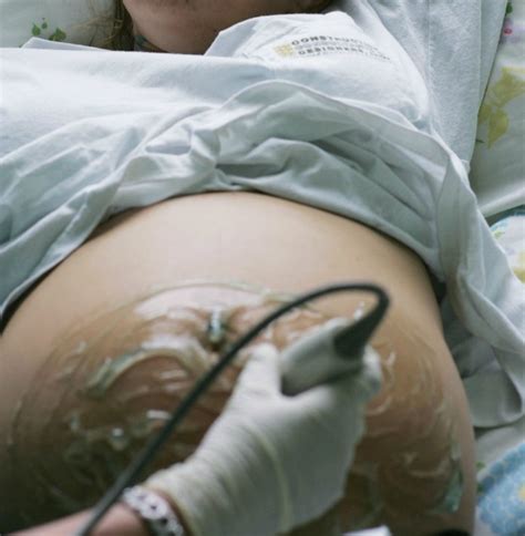Ultrassom Mostra Bebê Batendo Palma Dentro Da Barriga Da Mãe Assista