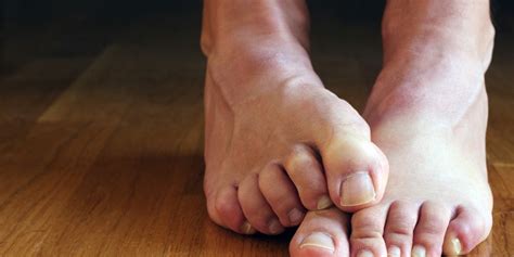 How To Fix Your Grossest Feet Problems Men S Health