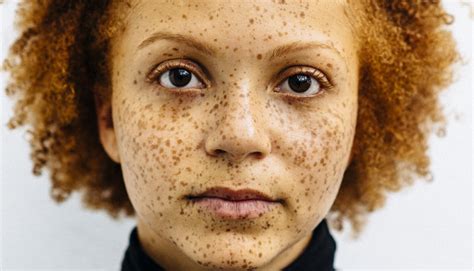 Feature “photographer Explores The Beautiful Diversity Of Redheads Of