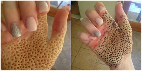Freaking People Out Who Suffer From Trypophobia Fear Of