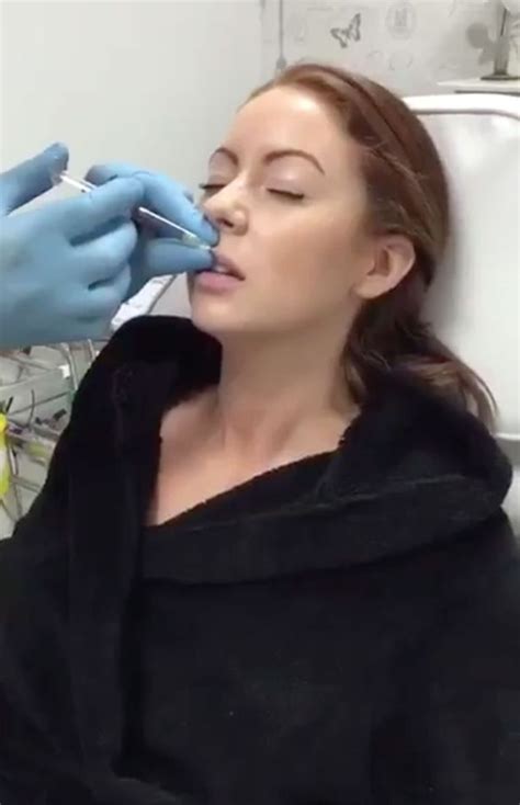 Big Brother S Laura Carter Has Her Lips Injected On Video And Shares It