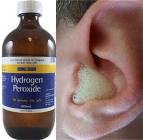 top home remedies  cleaning ears naturelieved