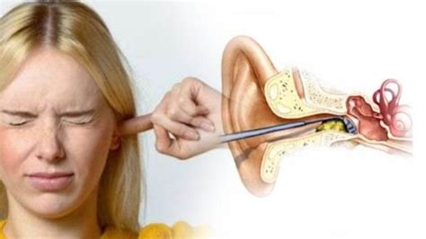 telinga tidak sakit  memakai anting emas homecare