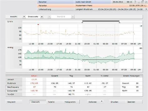 custo med custo diagnostic standard  medtechgalexiscom