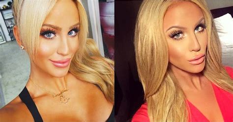 Can You Believe Gigi Gorgeous’ Before And After Plastic