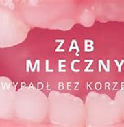 Image result for Co_to_znaczy_ząb_mleczny. Size: 181 x 110. Source: dentinfo.pl