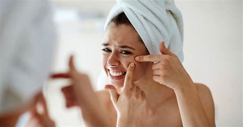 Acne Here Are Seven Things That Can Cause Acne And Heres What You Can