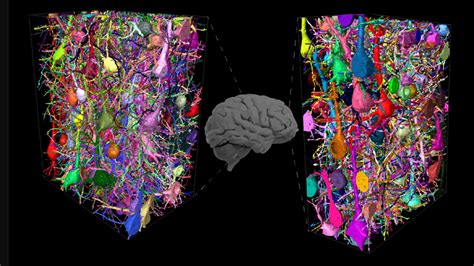 human brain  complex technology networks