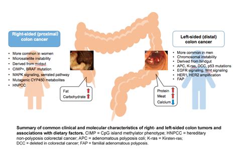 Colorectal Cancer Gendered Innovations