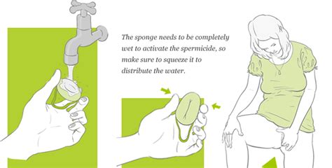 sponge birth control method