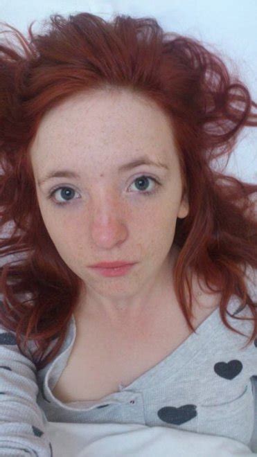 Freckles Are The Best [sfw] Porn Pic Eporner