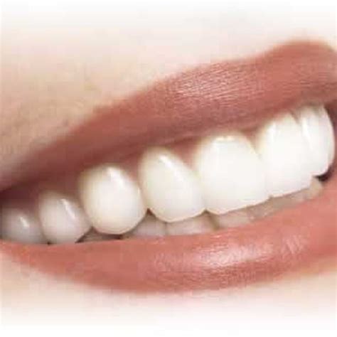 clean dental implants healthy living