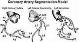 Coronary Perfusion Territories Myocardial Artery Lad Distal Posterior Left Circulation Aligning sketch template