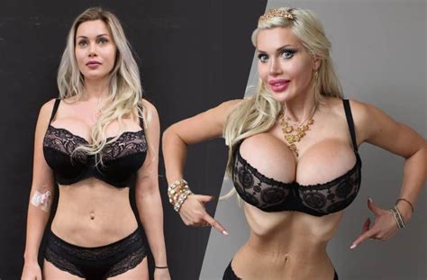 Surgery Loving Model Spends Over 120k To Look Like A