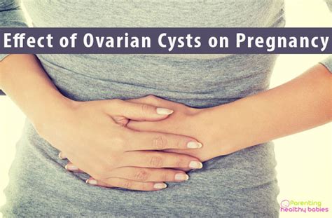 ovarian cysts affect pregnancy facts