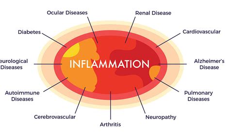 chronic inflammation       disease ambrose cell