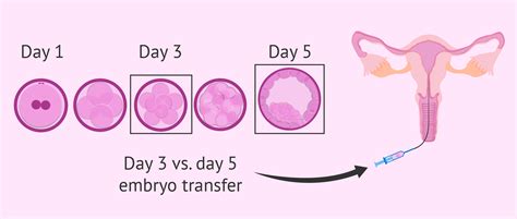 day  embryo transfer due date ayudhkristof