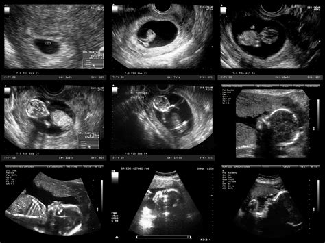 overview  early pregnancy fetal development
