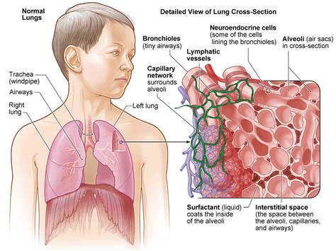 farmers lung  symptoms diagnosis treatment prognosis