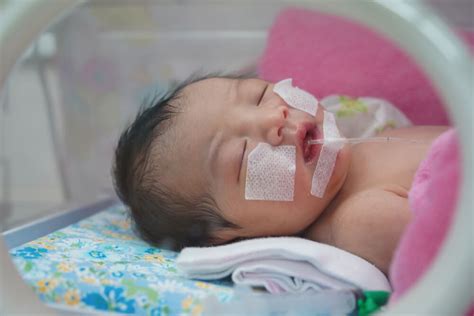 sindrome de dificultad respiratoria en el recien nacido eres mama