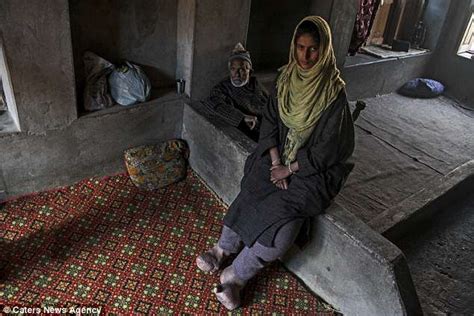 indian woman has never worn shoes due to elephantiasis daily mail online