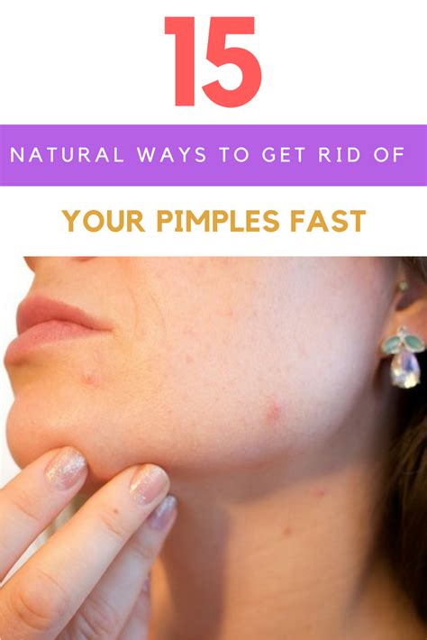 rid  pimples  home remedies  work