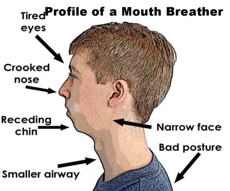 mouth breather more than an insult — second breath