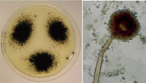 pin auf aspergillus