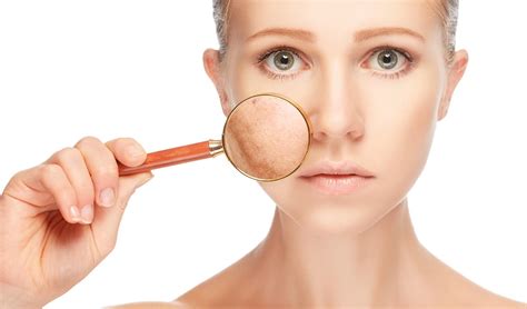 rekomendasi skincare  kulit wajah kering