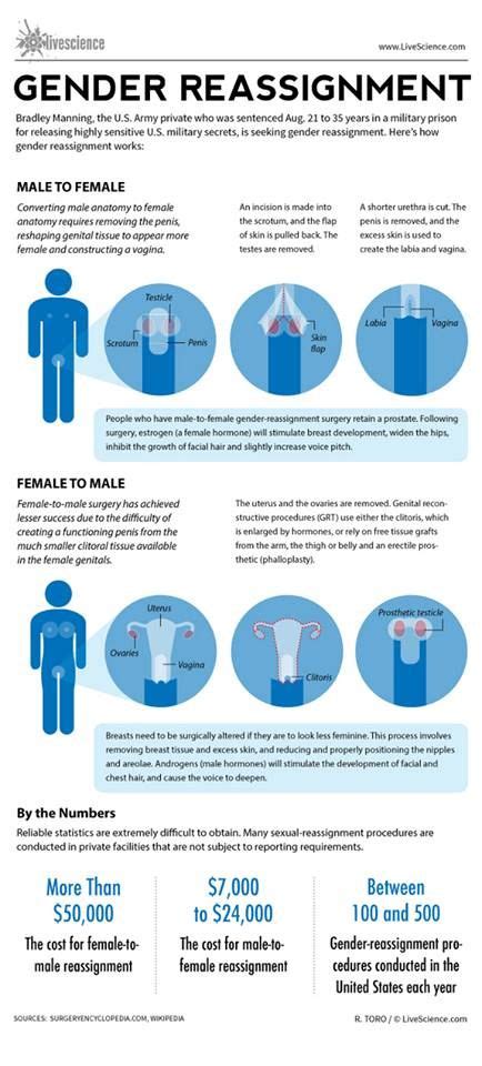 Gender Reassignment Procedure Summary Don T Assume That Just Because