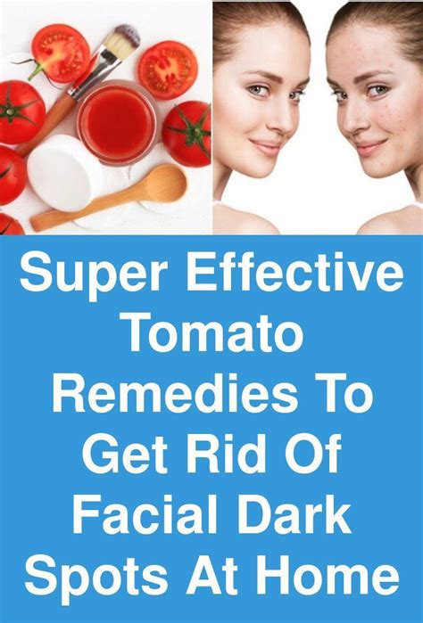 super effective tomato remedies to get rid of facial dark