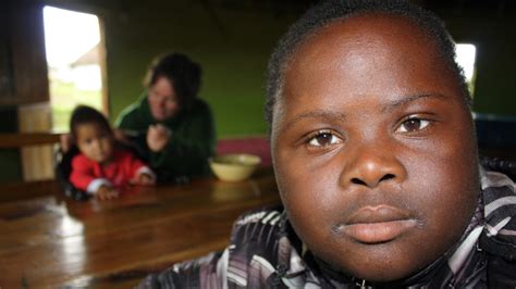south african boy  downs syndrome triumphs  prejudice page