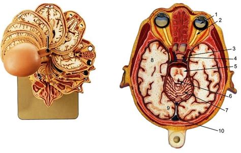 somso section model   head anatomy anatomymodels httpwwwgtsimulatorscomproduct p