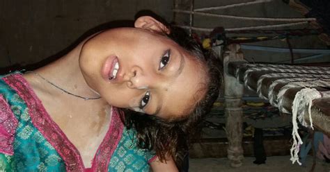Girl 9 Lives In Constant Pain As Mystery Condition Causes Her Neck To