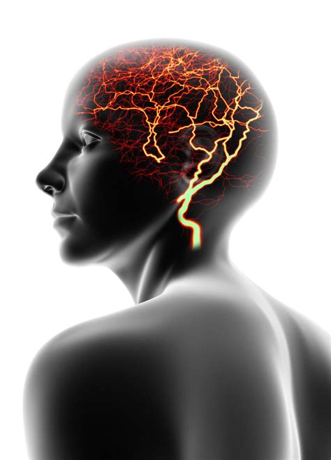 intractable epilepsy symptoms  diagnosis  treatment
