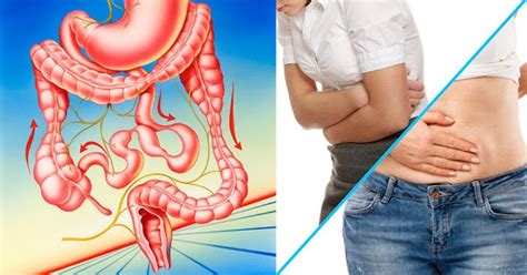 herbal medicine  signs  symptoms  irritable bowel syndrome ibs