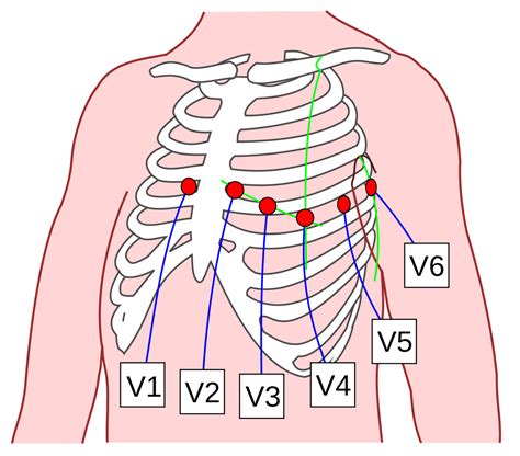 brustwandableitungen nach wilson precordial lead doccheck