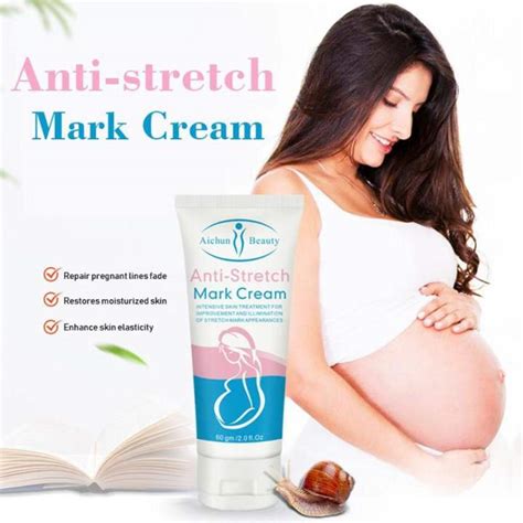 [ Best Selling ] Aichun Original And Authentic Stretch Mark Cream Dark