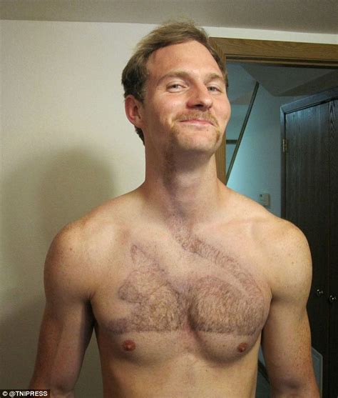 hairy chested males doctors
