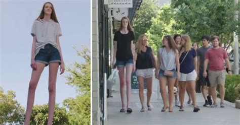 Teenager Who Has The World’s Longest Legs Aspires To Become A Model