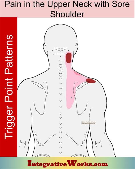upper neck pain  sore top  shoulder integrative works